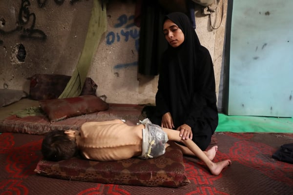 Displaced Palestinian mother holds her malnourished son inside a Gaza City school shelter, July 2025.