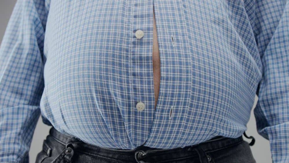 Cardiologist Savonina says overweight people tolerate chemotherapy more easily