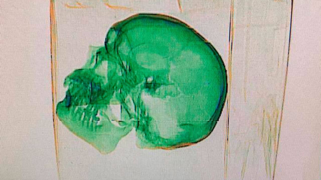 A human skull was found in one of the packages sent to the United States in Vnukovo