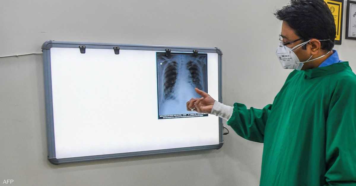 It kills 13,000 people a year. Alarming figures on tobacco