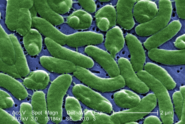 carnivorous bacterium from the USA, was found in the Black