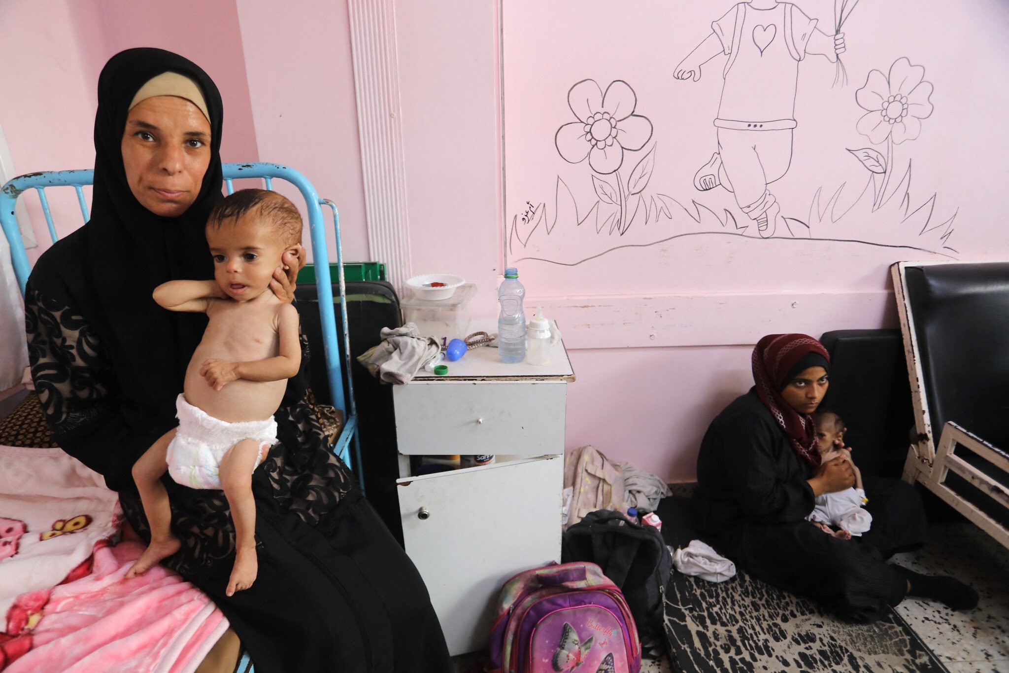 Gaza Hospital Treats Children For Severe Acute Malnutrition Gaza hospital pediatric ward treating children for severe acute malnutrition