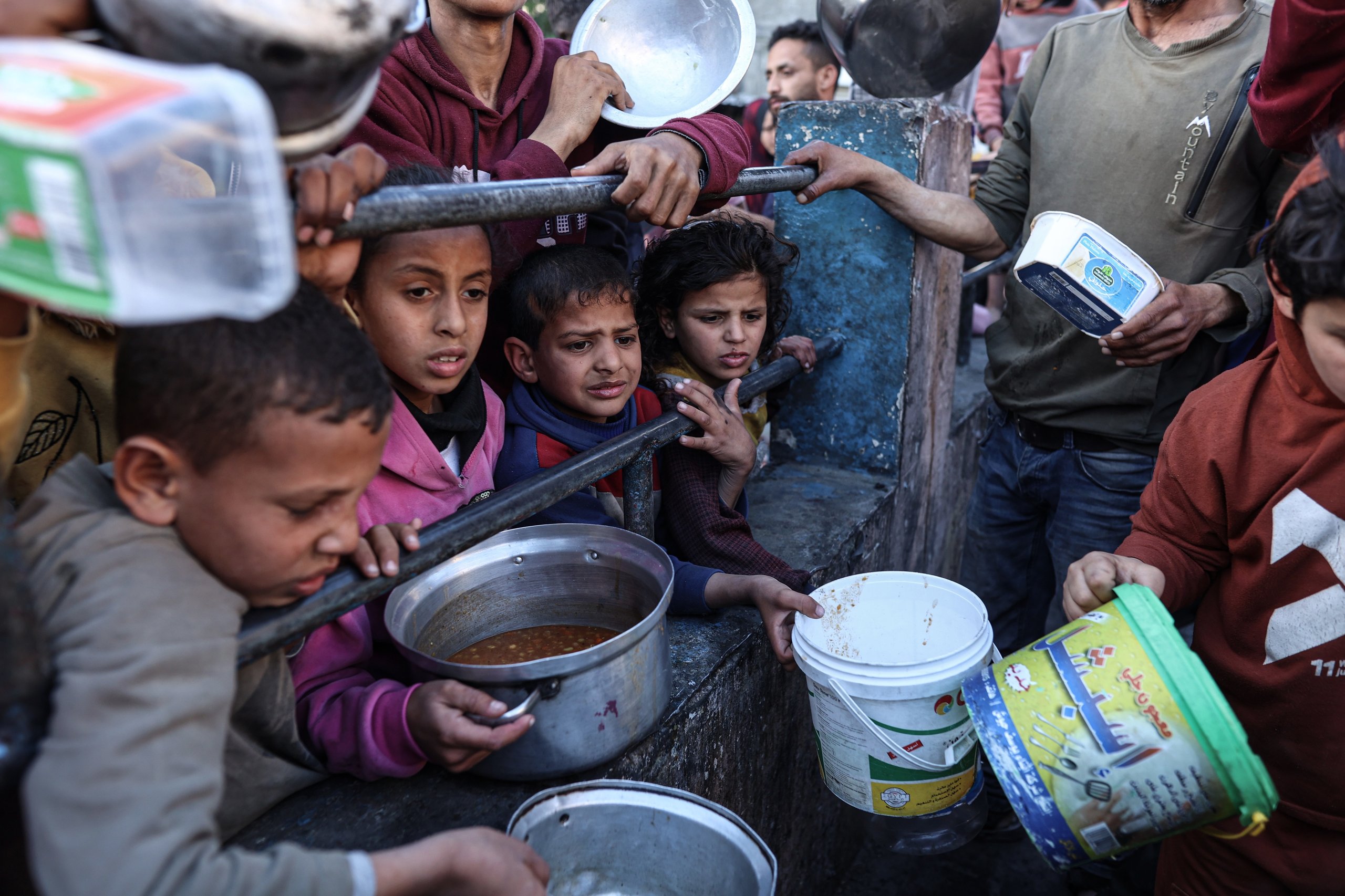 Gaza children face severe malnutrition amid famine Children in Gaza suffering from severe malnutrition during famine