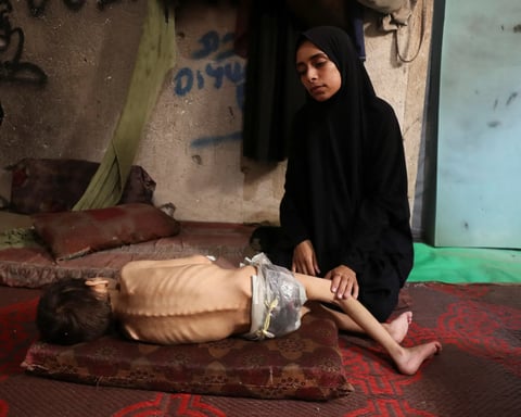 Displaced Palestinian mother holds her malnourished son inside a Gaza City school shelter, July 2025.