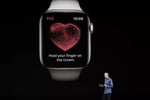 Apple Watch blood oxygen feature legal dispute ITC ruling Masimo