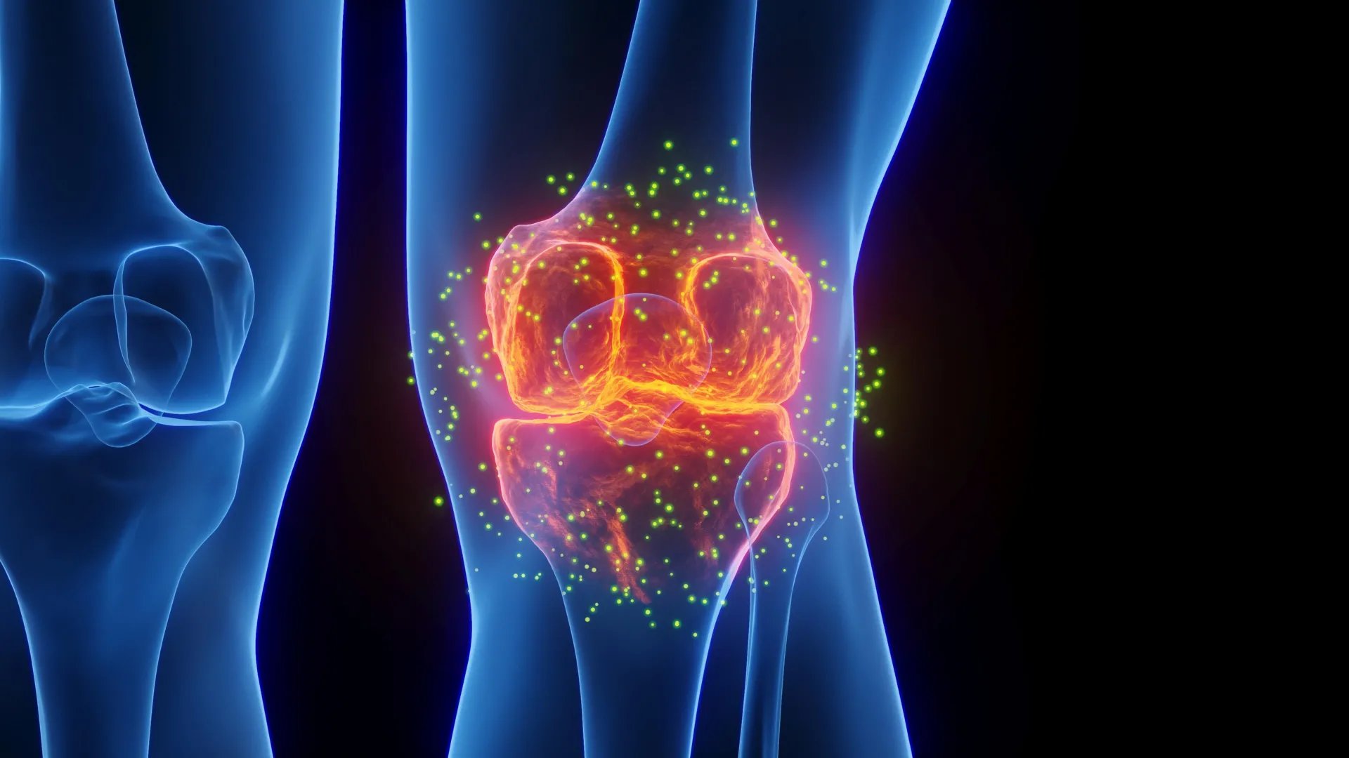 ARPA-H osteoarthritis breakthrough showing cartilage and bone regeneration in knee joint
