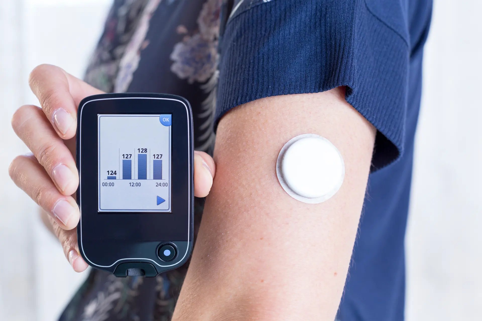 continuous glucose monitor sensor on arm showing real time glucose tracking on smartphone app