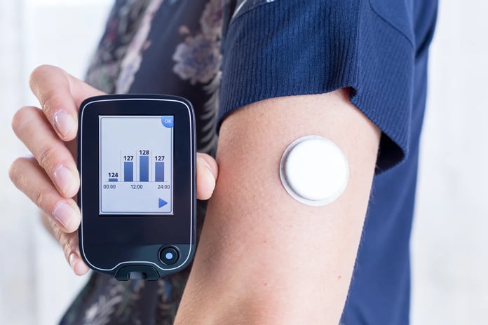 continuous glucose monitor sensor on arm showing real time glucose tracking on smartphone app