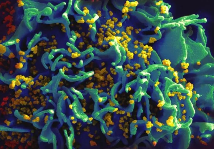 HIV Virus Under Microscope Microscopic view of HIV virus particles in the human body