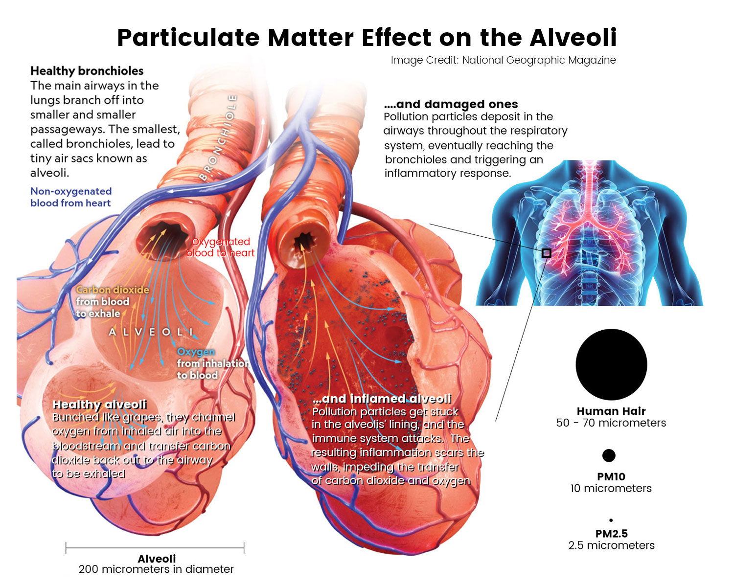 PM2.5 particles penetrating lungs and bloodstream