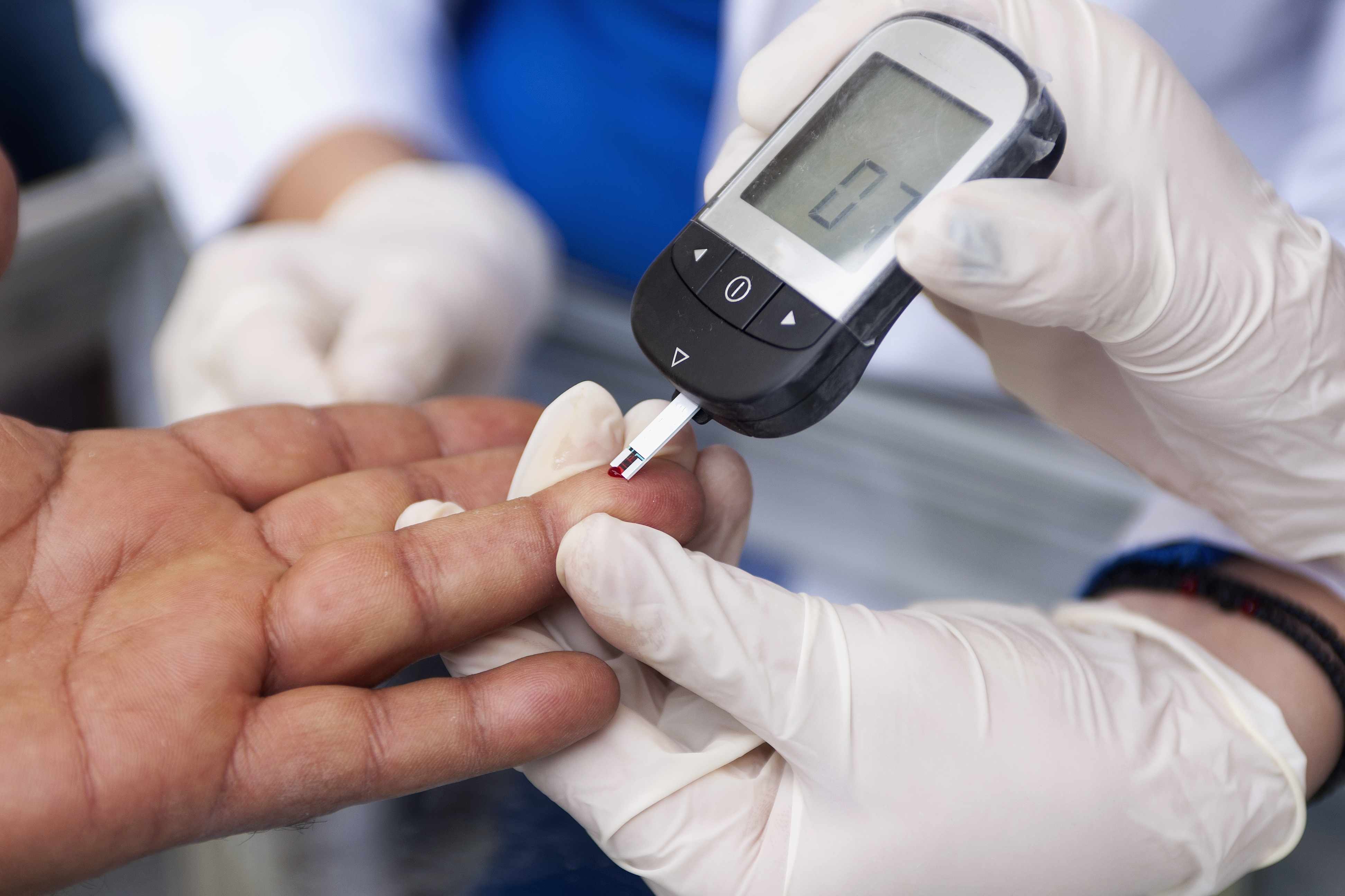 Doctor performing a finger-prick blood glucose test on a patient in Wales