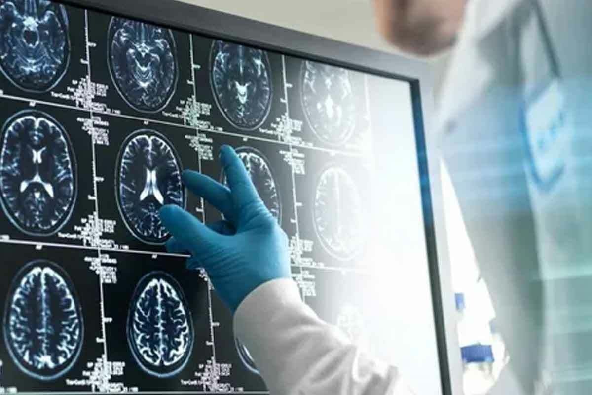 Neurological Damage From Vitamin B12 Deficiency Neurologist examining psychiatric and neurological scans
