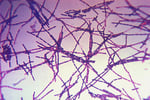 Hantavirus particles under electron microscopy from the CDC PHIL image library