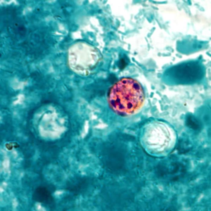Cyclospora cayetanensis oocysts seen under UV microscopy, the parasite behind US foodborne outbreak