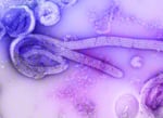 Colored scanning electron micrograph of Bundibugyo ebolavirus particles