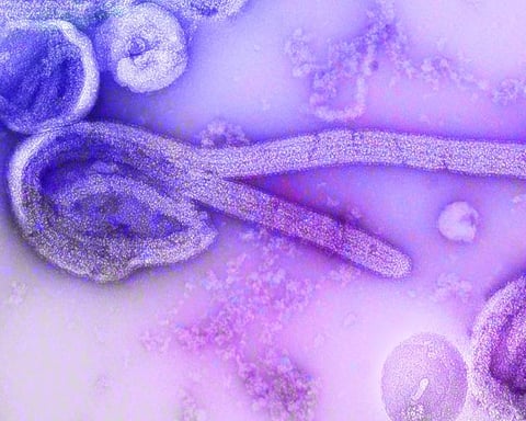 Colored scanning electron micrograph of Bundibugyo ebolavirus particles