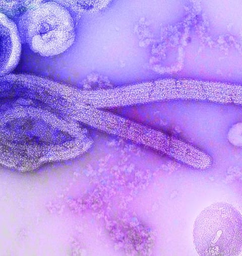 Colored scanning electron micrograph of Bundibugyo ebolavirus particles