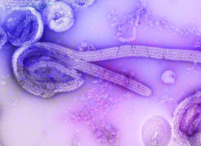 Colored scanning electron micrograph of Bundibugyo ebolavirus particles