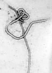 Electron micrograph of Ebola virus particles, the pathogen behind the 2026 DRC outbreak