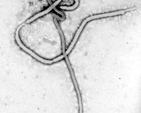 Electron micrograph of Ebola virus particles, the pathogen behind the 2026 DRC outbreak