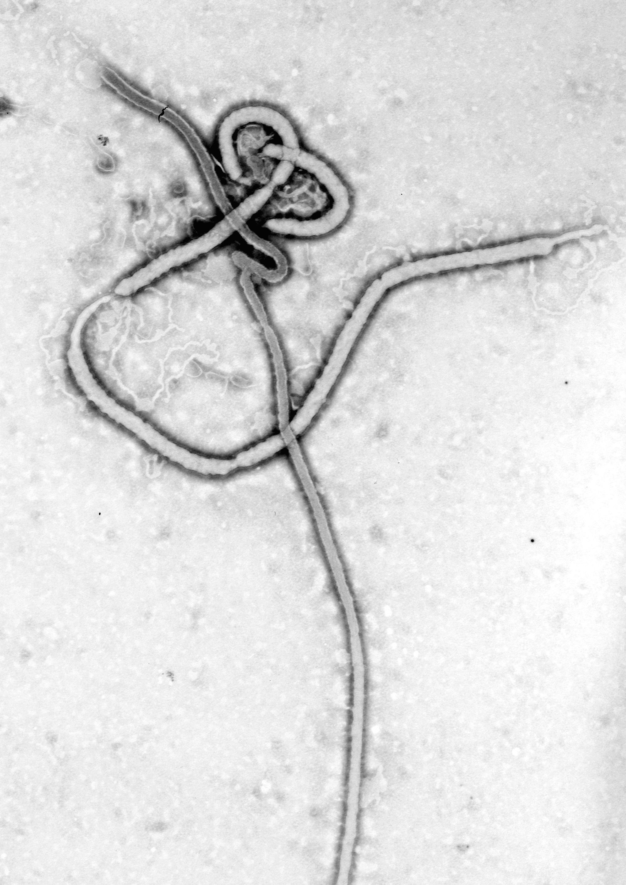 Colorized electron microscope image of Ebola virus particles from the CDC
