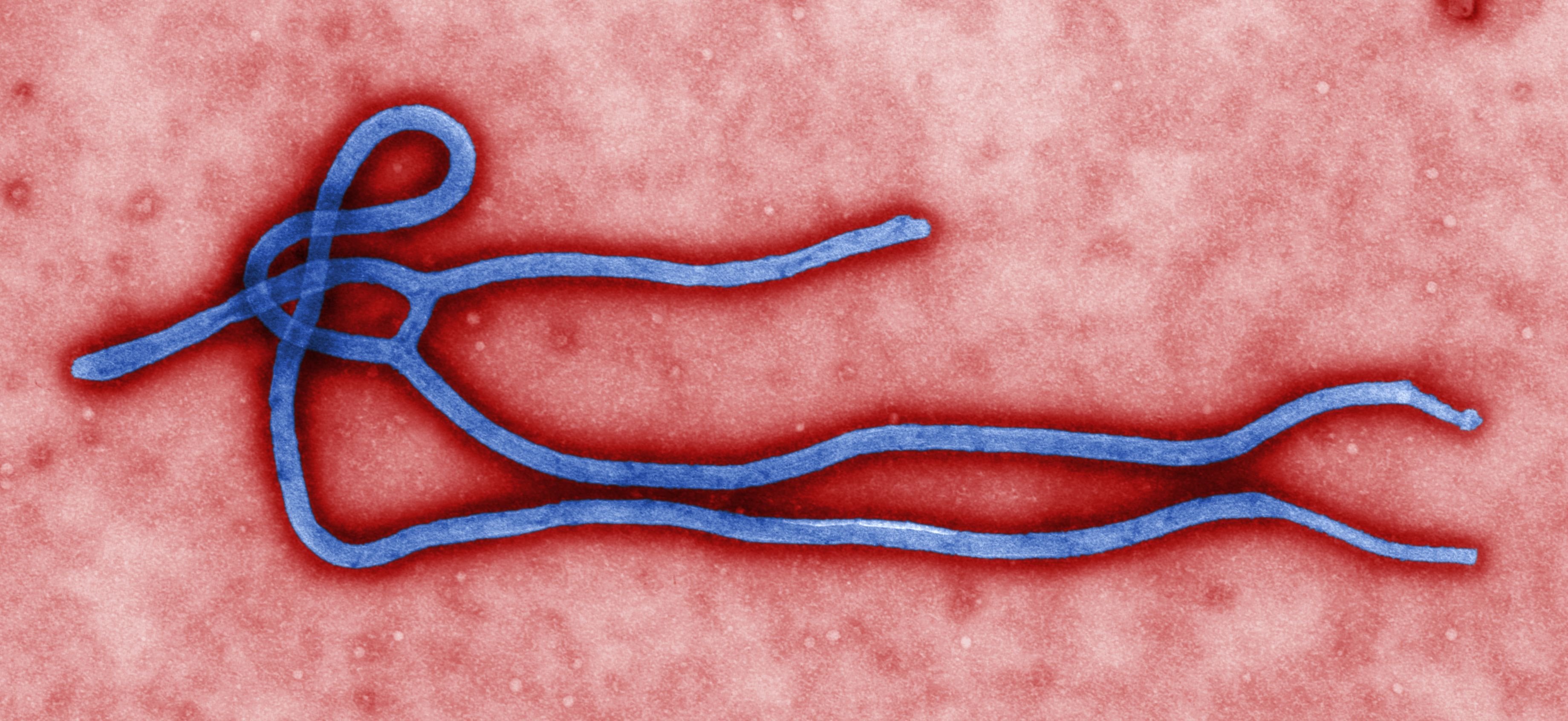 Colourised electron micrograph of an Ebola virion showing the characteristic filamentous structure of the virus