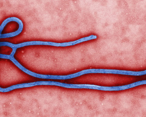 Electron microscope image of an Ebola virus virion