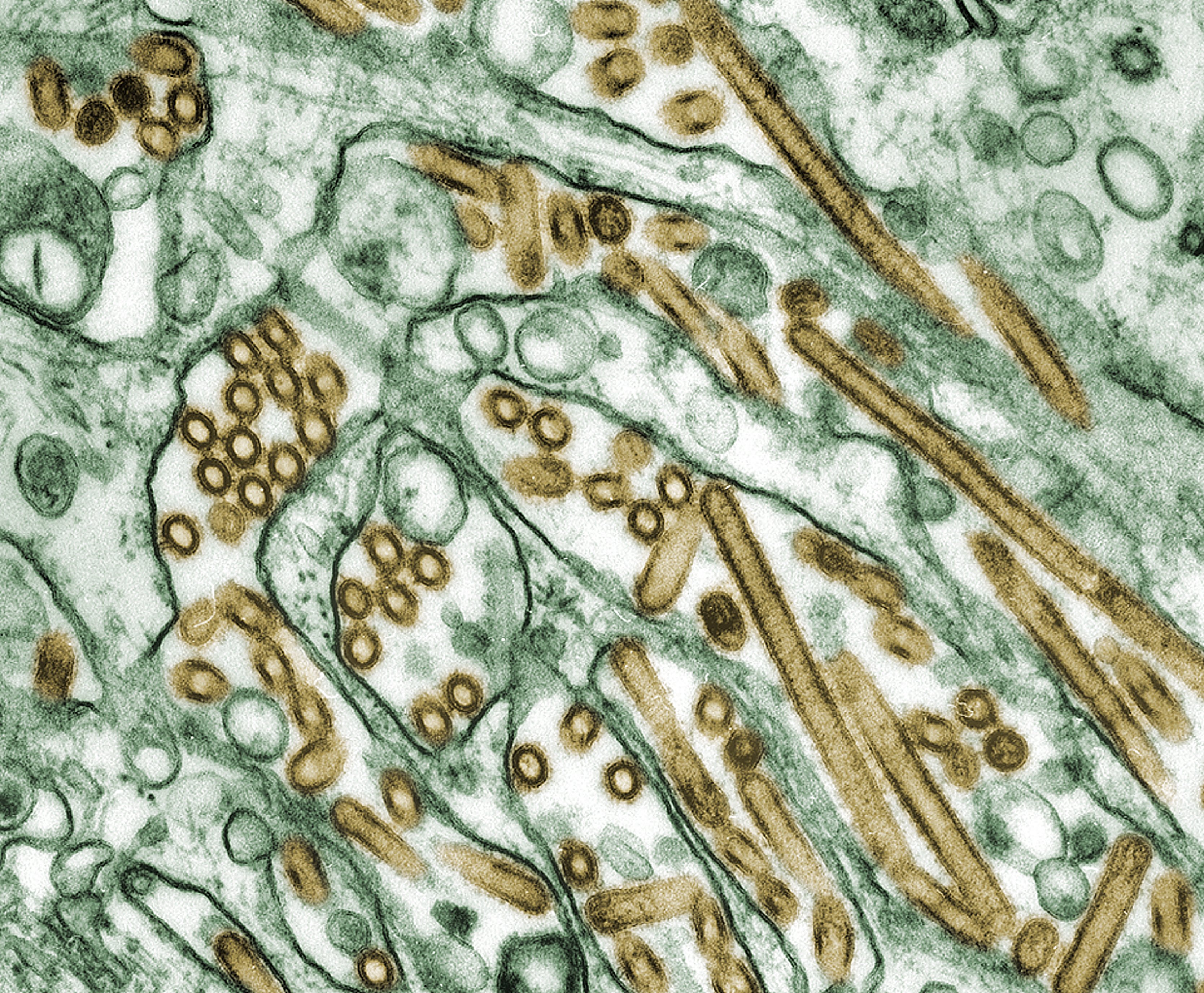 Colorized transmission electron micrograph of H5N1 avian influenza viruses, the strain found to colonize dairy cow mammary tissue