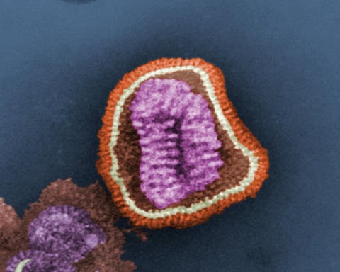 Colorized electron microscope image of influenza virus particles, the pathogen in the Lackland Air Force Base flu outbreak