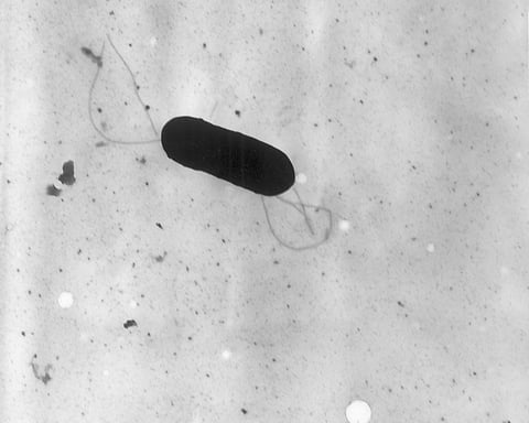 Electron microscope image of Listeria monocytogenes bacteria linked to the Clover Hill Dairy outbreak