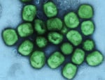 Colorized transmission electron micrograph of monkeypox mpox virus particles in green found within infected cell NIAID research