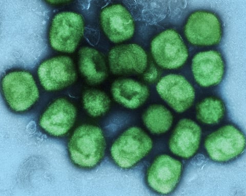 Colorized transmission electron micrograph of monkeypox mpox virus particles in green found within infected cell NIAID research