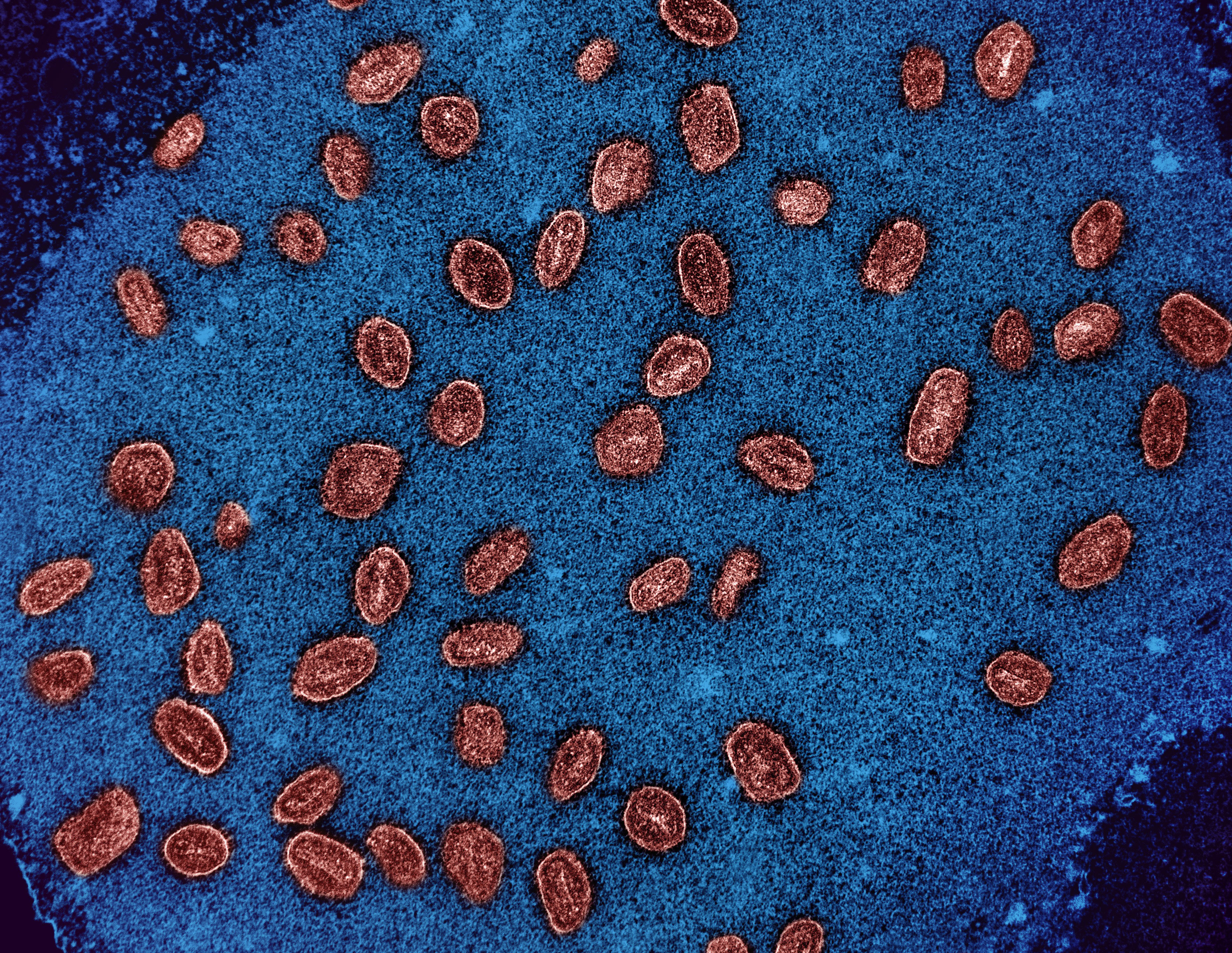 Colorized transmission electron micrograph of mpox clade Ib virus particles red found within VERO E6 cells various stages