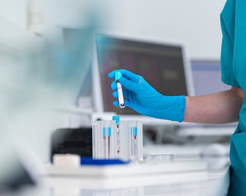 Medical professional holding a blood sample vial in a clinical setting, central to a Northwestern University JAMA study on apoB vs LDL cholesterol testing for statin therapy decisions