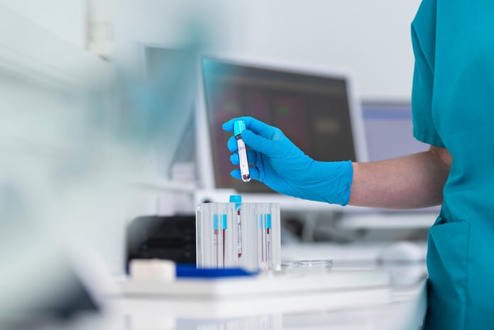 Medical professional holding a blood sample vial in a clinical setting, central to a Northwestern University JAMA study on apoB vs LDL cholesterol testing for statin therapy decisions