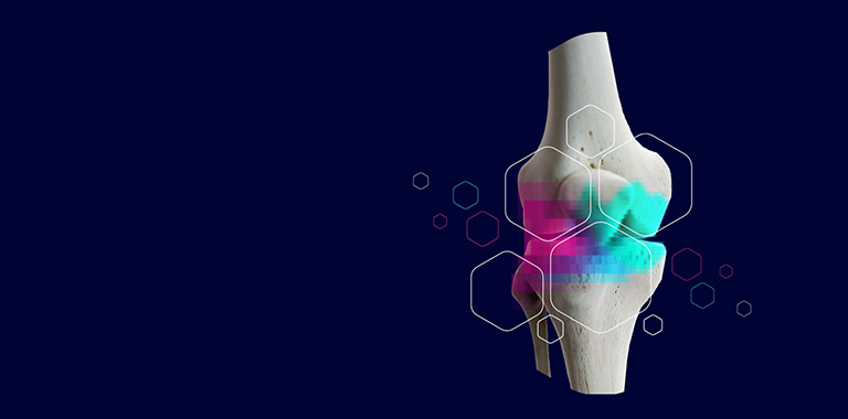 The ARPA-H NITRO program funds regenerative therapy research for osteoarthritis at University of Colorado Boulder, Duke, and Columbia University