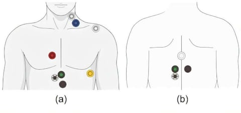 Non-invasive sensor devices used in Ateneo de Manila cardiac index AI study
