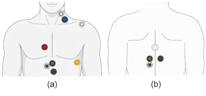 Non-invasive sensor devices used in Ateneo de Manila cardiac index AI study
