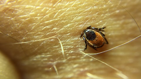 Close-up of a blacklegged tick embedded in human skin during peak tick season