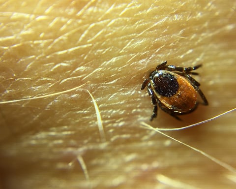 Close-up of a blacklegged tick embedded in human skin during peak tick season