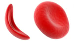 CRISPR gene editing used in Casgevy treatment for sickle cell disease patients
