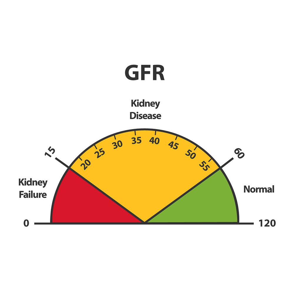 A glomerular filtration rate dial illustrating kidney function levels used to diagnose and stage chronic kidney disease