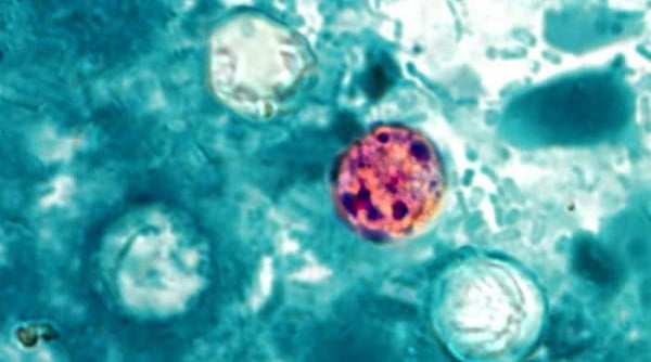 Microscopic view of Cyclospora cayetanensis parasite that causes cyclosporiasis food illness