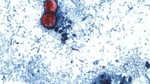 Cyclospora cayetanensis parasite under microscope CDC image Taco Bell lettuce outbreak 2026