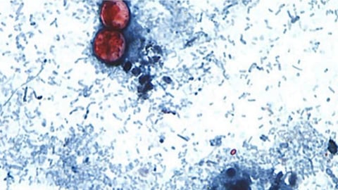 Cyclospora cayetanensis parasite under microscope CDC image Taco Bell lettuce outbreak 2026