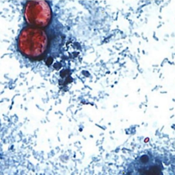 Cyclospora cayetanensis parasite under microscope CDC image Taco Bell lettuce outbreak 2026