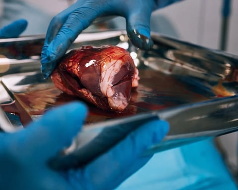 Surgeons in an operating room performing a kidney transplant procedure