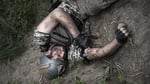 KAIST spray powder stops severe bleeding in one second hemostatic research 2026