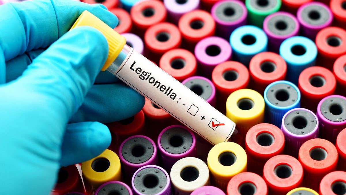 Microscopic view of Legionella bacteria responsible for the Upper East Side Legionnaires disease outbreak in New York City
