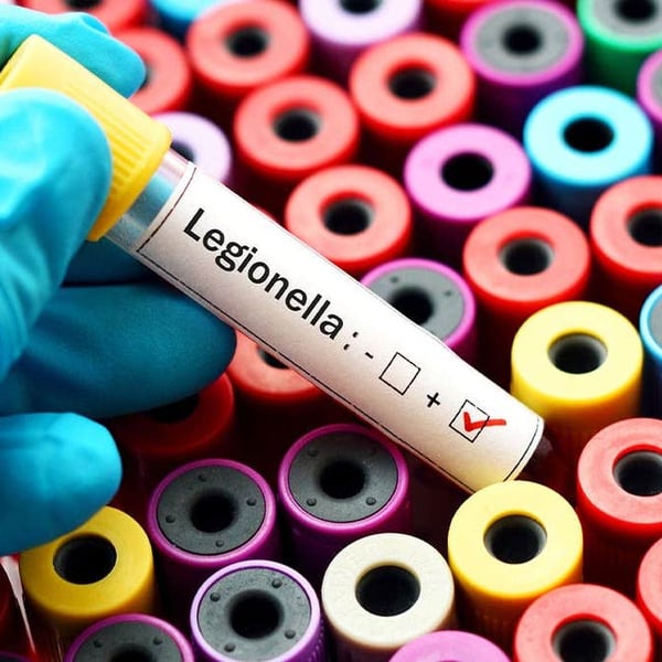 Microscopic view of Legionella bacteria responsible for the Upper East Side Legionnaires disease outbreak in New York City